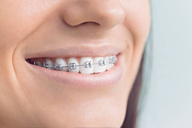 Best Full Mouth Reconstruction  in Bell, CA